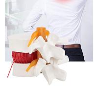 1 : 1 . 5 Anatomical Human Disc Herniation Model ,Vertebras Anatomicas Lumbar Spine Model Medical Demonstration Model Human Lumbar Disc Model for Linical TeachingCameras and Imaging