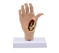 1:1 Hand Bone Joint Model, Right Hand Tendon Ligament Muscle Anatomy Teaching Aids, Pathological Deformed Hand Bone Skeleton
