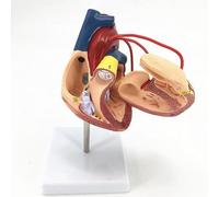 1:1 Life Size Scientific Human Heart Model, Natural Human Heart Bypass Surgery Anatomy Model, Held with 2 Detachable Parts, Mounted Display Base & Color Printed