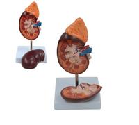 1.5X Larger Human Kidney Anatomy Model with Digital Sign Display Base, Digestive System Model, Kidney Human Anatomy Replica for Doctor-Patient Communication