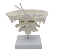 1.5X Magnification Human Cervical Model Occipital Bone Medical Teaching Educational Teaching Aid Spine Models for Chiropractors
