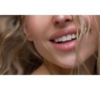 1 ml Dermal Filler