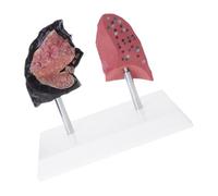 1 Smoker Vs Lung Anatomical Model PVC Clinical Teaching Tool for Fitness Education PVC Lung Demonstration Tool