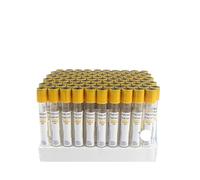 100pcs Sterile Vacuum Blood Collection Tubes EDTA K2 Heparin Lithium Sodium Clot Activator Plain Gel Fluoride Citrate 1:4 1:9 PET Glass PRP Tubes 1.6ml 3ml 5ml 10ml(5ml yellow)