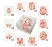 10PCS Brain Specimen Coasters 3D Halloween Square Anatomic Brain Coasters Funny Acrylic Organ Brain Slices Coasters for Neuroscience Medical Student Scientists Human Anatomy Gift Brain Slices Decor