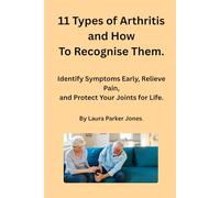 11 Types of Arthritis and How To Recognize Them.: Identify Symptoms Early, Relieve Pain, and Protect Your Joints for Life. (How to live with arthritis)