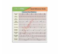 12 Lead ECG Study Guide Electrical Activity of Heart PQRST Complex PR Interval and QT Segment Reference(Framed,12x18inch(30x45cm))