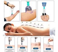 12-Piece Cupping Therapy Set - Vacuum Massage Cups for Traditional Chinese Cupping, Pain Relief & Relaxation