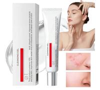 15% Acid Acne Treatment Gel,Anti Acne Face Cream,Face Acne Treatment,Acid 15% Facial Serum Cream,Spot Treatment,Gentle Acne Cream,Spot Serum Cream for Face,Pimple Treatment Gel Cream,Face Gel for Acne