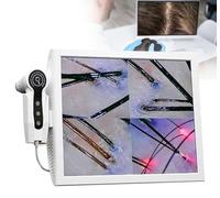 15-Inch 1000MP Scalp Camera with Integrated Image Storage & Rechargeable Battery for Salon & Home Use - Ideal for Hair Health Monitoring & Scalp Analysis
