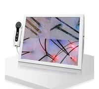 15-Inch HD Scalp Camera & Portable Skin Pigment Tester - Dual Probe Oil & Moisture Detection for Enhanced Scalp Health & Skin Analysis