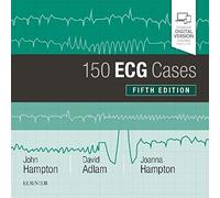 150 ECG Cases, 5e, Paperback