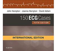 150 ECG Cases, International Edition