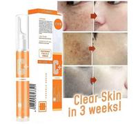 15ml Instant Blemish Removal Gel Face VC Whitening Freckle Serum Brighten Skin