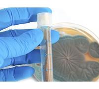 1928-The Discovery of Penicillin