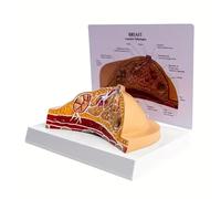1pc Artificial Human Pathological Female Breast Model - Medical Disease & Cancer Anatomical Models