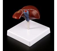 1pc Human Liver Pathological Anatomical Model Anatomy School Medical Teaching Display Tool Lab Equipment Medical Props Model
