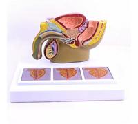 1pc Human Male Pelvis Prostate Pathology Sagittal Section Model Medical School