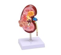 1pc Kidney Pathologies Model Human Body Anatomy Replica Of Diseased Kidney For Doctors Office Educational Tool Anatomicals