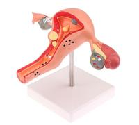 1Pc Medical Props Model Pathological Uterus Ovary Anatomical Model Anatomy Cross Section Study Tool
