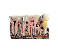 1Pcs Dental Model Caries Anatomy Model Comprehensive Pathology Tooth Nerve Tooth Model Dental Oral Teaching Demo Teeth Model(Type2)