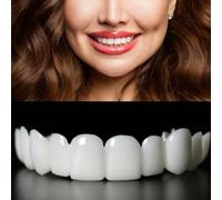 2 Pairs, Regain Confidence Smile for Women and Men, Temporarily Adjustable(Yellow)