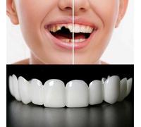 2 Pairs, Regain Confident Smile Temporarily Adjustable, Nature and Comfortable for Men and Women