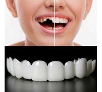 2 Pairs, Temporarily Adjustable for Men and Women, Regain Confidence Smile Nature and Comfortable(White)