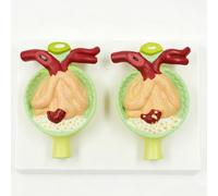 2-Part Urinary Protein Comparative Display Model, Human Kidney Organ Structure Model, Nephron Glomerulus Simulator, Clear Texture & Digital Labeled, for Patient-Physician Communication