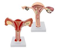 2 pcs Packed Merinden Human Uterus & Ovary Anatomical Model Pathological Uterus & Ovary Uterus(2 Parts) Life-Size Realistic Female Anatomical Organs for Medical Science Education Study or Teaching