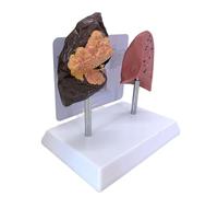 2. Realistic Puffing Lung & Non-Smoker Lung Comparison PVC Structure Classroom Educational Puffing Consequences Display