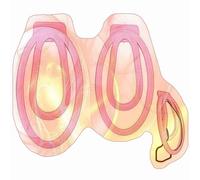 2 Sizes Male Lightweight Protection Fufu Clips, Protection Cage Accessories Set for Men -UKHA24 (Pink)