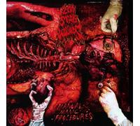 200 Stab Wounds - Manual Manic Procedures