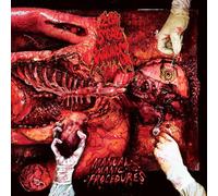 200 Stab Wounds - Manual Manic Procedures