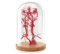 2026 New Life-Size Intracranial Brain Artery Model, High-Precision Whole Brain Vascular Model Intracranial Vascular Education Displa for Medical Learning Teaching