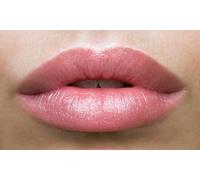 2ml Dermal Filler Treatment for lips or Cheek or Jawline with consultation