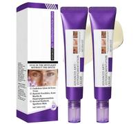 2PCS Pi/gmentation Removal Cream For Face Cream, Remover Dark Speckle Cream, Face Skin Corrector,Anti Aging Face Cream,Retinol Serum for Face,Night Moisturiser,retinol night cream for Women&Men