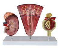 3-Part Human Kidney Model with Nephron and Glomerulus, Anatomical Renal Structure Model on Base for Teaching Demonstration and Explanation