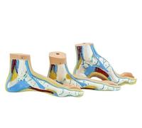 3-Piece Feet Model, Human Foot Pathology Anatomy Models, Including Flat Feet High Arches and Normal Feet with Explanation Cards, for Medical Experimental Teaching