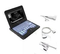3 Probe Portable Laptop machine Digital ultrasound scanner Convex/Linear/Vaginal