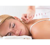 30-Minute Acupuncture Session with 30-Minute Swedish Massage and 10-Minute Consultation