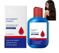 300ml Scalp Care Shampoo,Selen/ium Sulfi/de Shampoo,Oil Control Refreshing Anti-Dandruff Cleansing Shamp/oo,Anti-Dandruff Shampo/os,Hair Care Shampo/os,Dandruff Scalp Treatment
