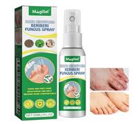 30ml Athletes Foot Odour Spray, Foot Peeling for Dead Skin and Calluses, Relieve Itchy Feet, Cracked Dead Skin Care for Remove Odor