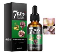 30ML Ginger Nail Treatment,7 Days Nail Fungus Treatment,Fungal N/ail Tre/atment for Toenails Extra Strong,Nai/l Fungus Tre/atment for Toenail,Anti Fungas Na/il Repeir and Strengthen,Ginger Na/il Serum
