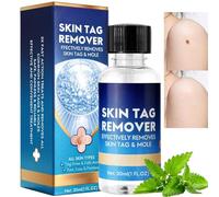 30ml Skin Tag Remover Serum,Deep Verruca Removal,Fast Acting & Painless Wart Remove,Skin Tag Remover Freeze Off,Skin Tag Remove for Hands and Body,Natural Removal without Leaving Traces,Non-Irritating