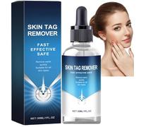 30ml Wart Remover,Wart Freeze Removal,Skin Tag Remover Liquid,Gentle Removal of Common Warts,Wart Remover for Hands,Tags and Mole Remover,Natural & Safe Remover,Suitable for Hands and Feet,Easy to Use