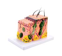 35/50/70/85X Enlarged Skin Model Skin Anatomical Model Teaching Tool for Classroom Study Display Teaching Medicals