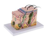 35X Magnified Human Skin Anatomy Model - Dermatology & Biology Teaching Tool - Scientific Research Display with Detachable Parts