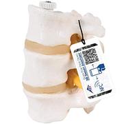 3B Scientific 3 Lumbar Vertebrae Flexibly Mounted + free anatomy software - 3B Smart Anatomy
