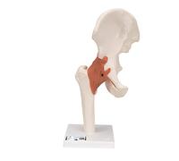 3B Scientific A81 Functional Hip Joint + free anatomy software - 3B Smart Anatomy
